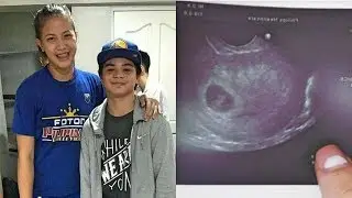 Bugoy Cariño tanggal sa Hashtags after mabuntis ang Girlfriend na si EJ Laure!!