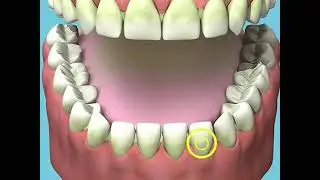 Smoking Effects on Teeth Risks Addiction 😥