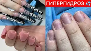 АРОЧНОЕ НАРАЩИВАНИЕ ИЛИ САЛОННОЕ МОДЕЛИРОВАНИЕ🤔ПРЕОБРАЖЕНИЕ НОГТЕЙ С ГИПЕРГИДРОЗОМ 💦