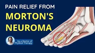 Relief from Morton's Neuroma, Foot pain | Symptoms and Causes