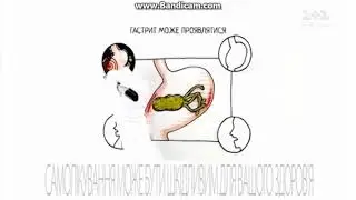 Реклама Де Нол и Фосфалюгель/ таблетки Де-нол и Фосфалюгель/ Реклама медицинских препаратов