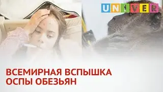 ВСЕМИРНАЯ ВСПЫШКА ОСПЫ ОБЕЗЬЯН