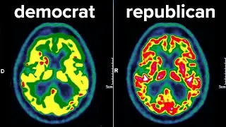 I Scanned A Democrat & Republican's Brains