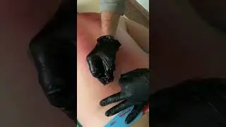 Костоправ Ковальчук, в Инстаграм больше видео . nikolaikovalchuk56