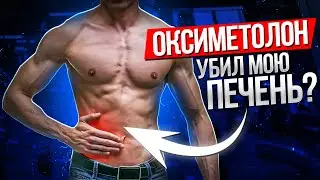 100 дней принимал Оксиметолон. Результаты эксперимента по влиянию Оксиметолона на печень.