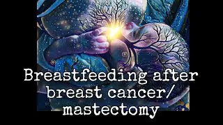 Breastfeeding after breast cancer