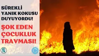 Şok Eden Çocukluk Travması! Yanık Kokusu!