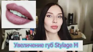 Увеличение губ Stylage M: гематомы, комки в губах, докоррекция