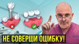 Лучшая альтернатива ЗУБНЫМ ИМПЛАНТАМ! Что выбрать вместо имплантации?