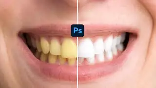 How To Whiten Yellow Teeth In Photoshop | 
