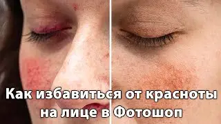 Как избавиться от красноты на лице в Фотошопе [Убираем красные пятна и прожилки и наводим красоту]