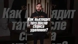 Как исчезает тату? Этапы лазерного удаления #shorts