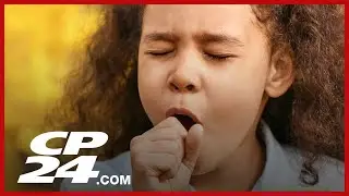 Whopping cough spreading across Canada