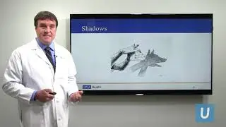 Management of Eye Floaters | Colin McCannel, MD, FACS, FRCSC | UCLAMDChat