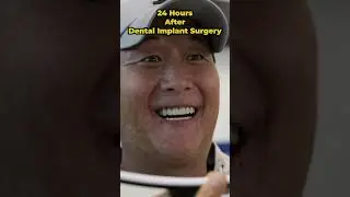 24 Hours After Dental Implant Surgery! 🤯 #shorts