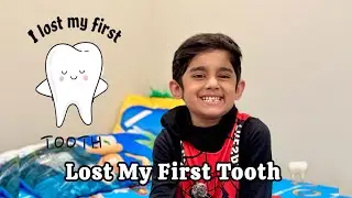 ABDUL RAHMAN LOST HIS FIRST TOOTH 🦷