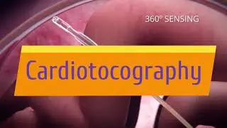 Cardiotocography Trailer