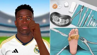 ASMR Perennial toenail removal | Vinícius Jr treat his feet