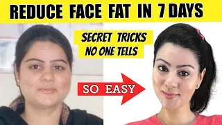 How To Lose Face Fat Fast🔥 Face Fat Exercises to Get Rid of Chubby Cheeks & Double Chin + Diet Tips