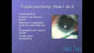 Glaucoma Lecture Series 7: Trabeculectomy