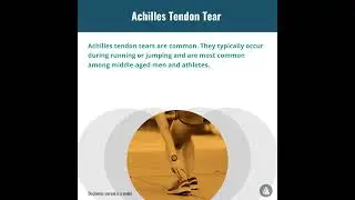 Common Olympics Injuries: Achilles Tendon Tears | Merck Manuals