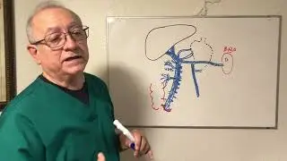 Anatomia del Sistema Porta. Hipertensión portal. Ascitis, varices esofágicas y hemorroides externas