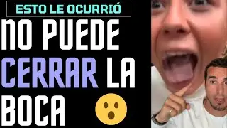 Abrió tanto la BOCA que no la PUDO CERRAR - ¿Te ha PASADO alguna vez? Aquí te explico el motivo