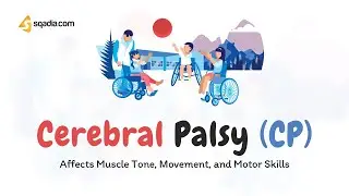 Cerebral Palsy (CP) | Etiology, Spastic, Dyskinetic, Ataxic, Diagnosis and Treatment