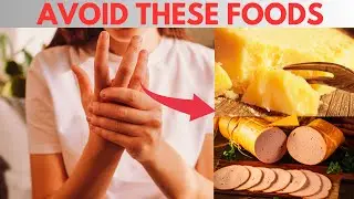 Rheumatoid Arthritis! 7 Foods You Should NEVER Eat Again in 2024