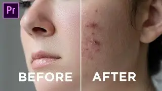 Skin Retouching Premiere Pro-Secret Tool | How to Smooth out Skin in Premiere Pro