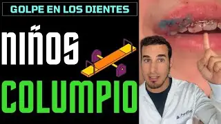 GOLPE en los DIENTES con BRACKETS - NIÑOS COLUMPIO 👄Smashmouth