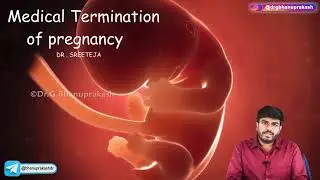 Medical Termination Of Pregnancy : Obstetrics and Gynaecology Lecture