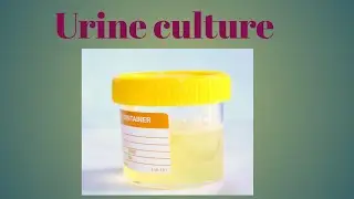 Urine Culture Test Procedure: Step-by-Step Guide