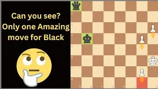Why you 