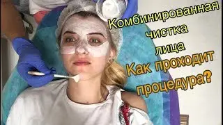 ЧИСТКА ЛИЦА - МОИ ВПЕЧАТЛЕНИЯ || КАК ПРОХОДИТ ПРОЦЕДУРА ?