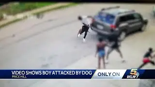 Dog attacks child, man who intervened in Price Hill