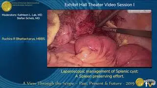 Laparoscopic management of Splenic cyst: A Spleen preserving effort