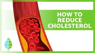 How to LOWER CHOLESTEROL Naturally ✅ | 10 Foods that Lower Cholesterol