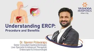 Understanding ERCP: Procedure and Benefits | Yashoda Hospitals Hyderabad