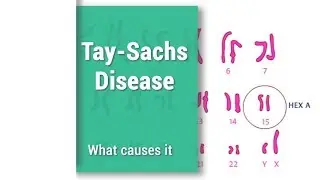 Tay-Sachs Disease | THD | Hex A | Hexosaminidase A