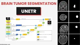 Brain Tumor Segmentation using UNETR in TensorFlow | Vision Transformer for Image Segmentation