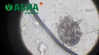 Чесоточный клещ