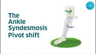 The ankle syndesmosis pivot shift Are we reviving the ACL story?