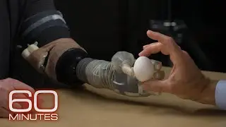 How advancements in prosthetic technology allow feeling, control | 60 Minutes