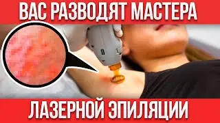 КОСМЕТОЛОГИ ВАС ОБМАНЫВАЮТ! / Как НАДУВАЮТ на лазерной эпиляции?