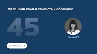 Меланома кожи и слизистых оболочек. 22.06.23.