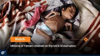 Millions of Yemeni children on the brink of starvation