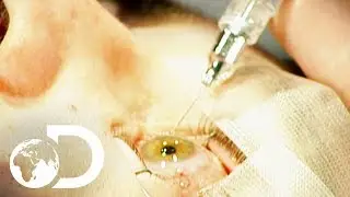 LASER EYE SURGERY | How It's Made