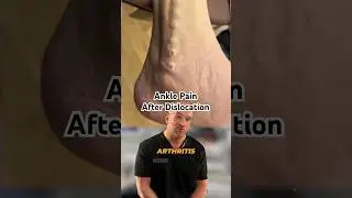 Ankle Dislocation Guarantees Severe Ankle Arthritis 🏃‍♂️ #shorts