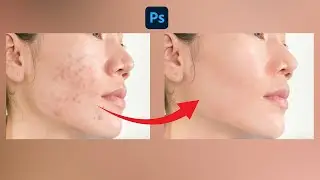 High End Skin Retouching Photoshop Tutorial |Remove Pimples | Photoshop Tutorial